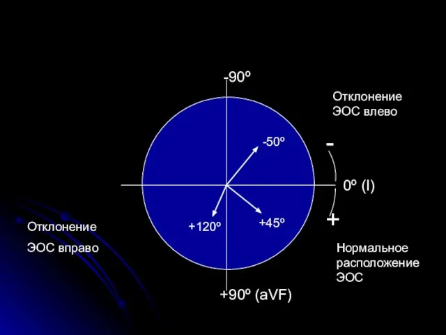 0º (I) +90º (aVF) -90º - + -50º +45º +120º Отклонение