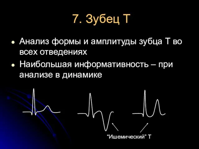 7. Зубец Т Анализ формы и амплитуды зубца T во всех