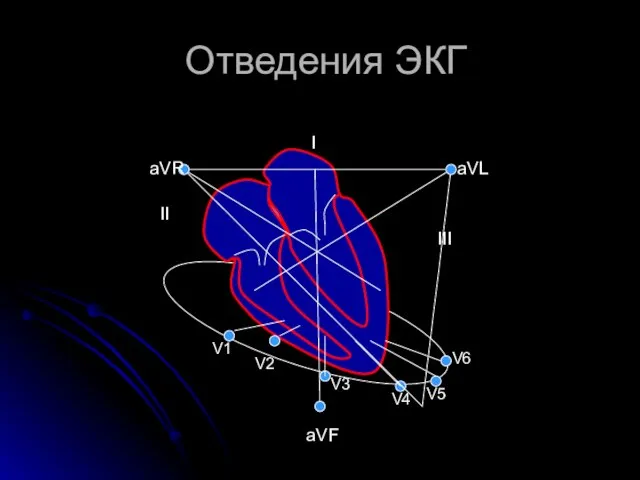 Отведения ЭКГ II III I aVR aVL aVF V1 V2 V4 V5 V6 V3