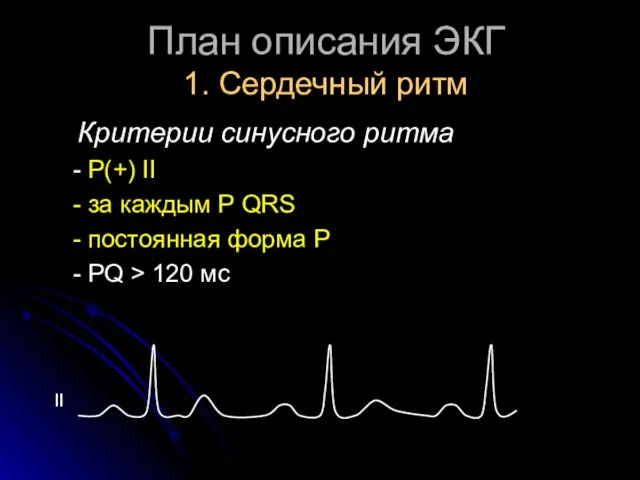 План описания ЭКГ 1. Сердечный ритм Критерии синусного ритма - Р(+)