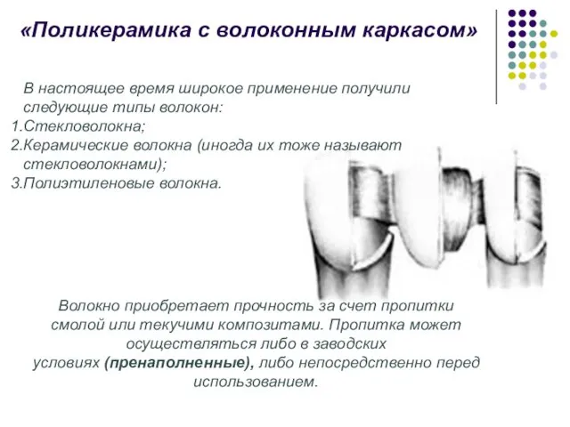 «Поликерамика с волоконным каркасом» В настоящее время широкое применение получили следующие