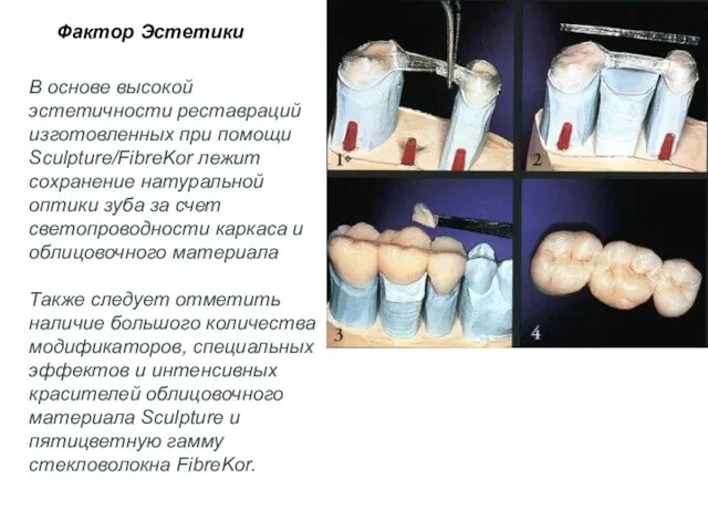 Фактор Эстетики В основе высокой эстетичности реставраций изготовленных при помощи Sculpture/FibreKor