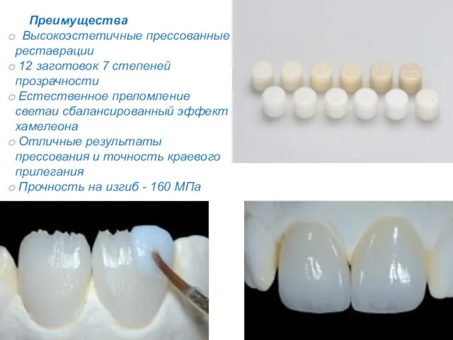 Преимущества Высокоэстетичные прессованные реставрации 12 заготовок 7 степеней прозрачности Естественное преломление