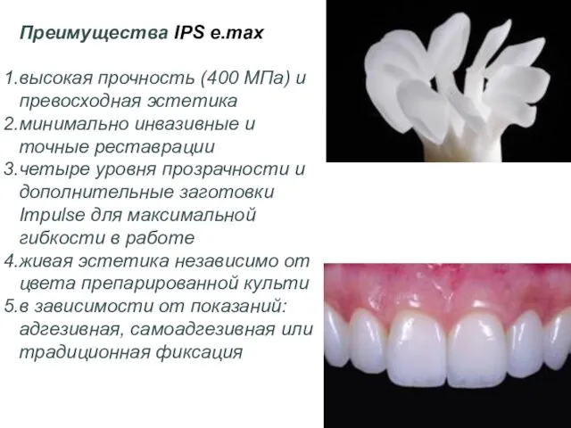 Преимущества IPS e.max высокая прочность (400 МПа) и превосходная эстетика минимально