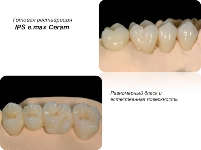 Готовая реставрация IPS e.max Ceram Равномерный блеск и естественная поверхность