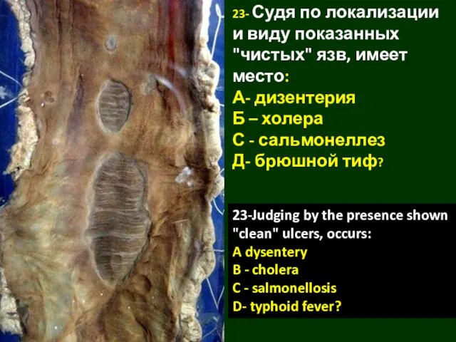 23- Судя по локализации и виду показанных "чистых" язв, имеет место: