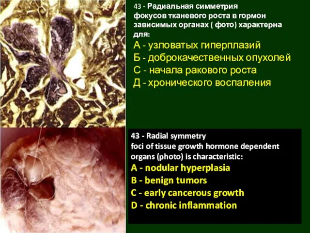 43 - Радиальная симметрия фокусов тканевого роста в гормон зависимых органах