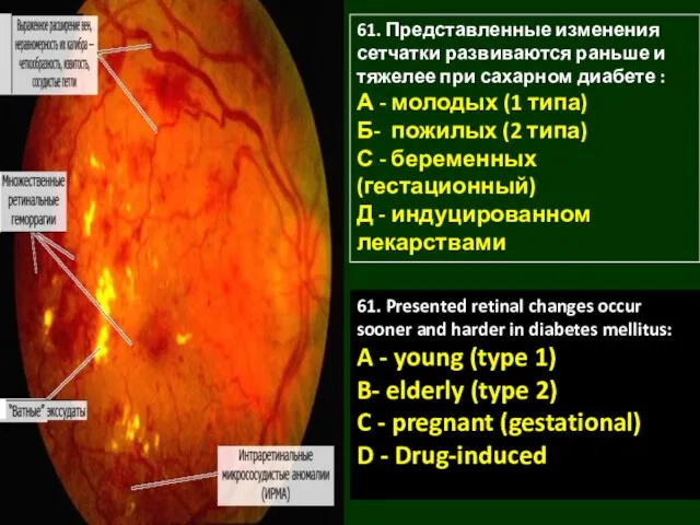 61. Представленные изменения сетчатки развиваются раньше и тяжелее при сахарном диабете