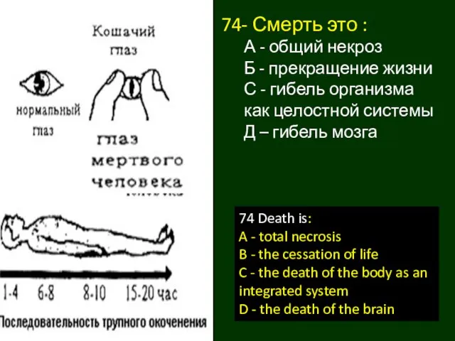 74- Смерть это : А - общий некроз Б - прекращение