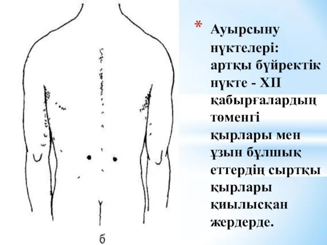 Ауырсыну нүктелері: артқы бүйректік нүкте - ХІІ қабырғалардың төменгі қырлары мен