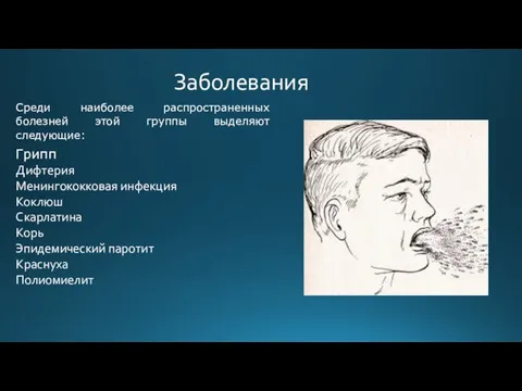 Заболевания Среди наиболее распространенных болезней этой группы выделяют следующие: Грипп Дифтерия