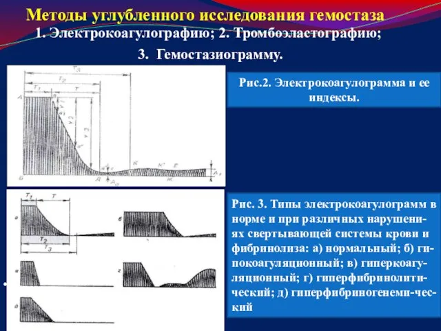 Методы углубленного исследования гемостаза 1. Электрокоагулографию; 2. Тромбоэластографию; 3. Гемостазиограмму. .