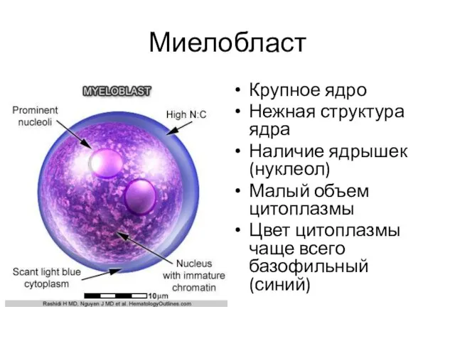 Миелобласт Крупное ядро Нежная структура ядра Наличие ядрышек (нуклеол) Малый объем