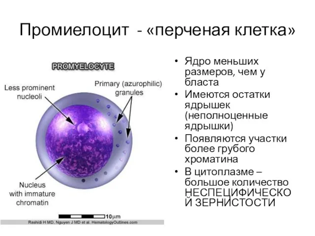 Промиелоцит - «перченая клетка» Ядро меньших размеров, чем у бласта Имеются