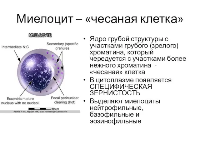 Миелоцит – «чесаная клетка» Ядро грубой структуры с участками грубого (зрелого)