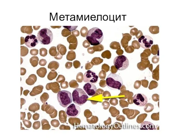 Метамиелоцит