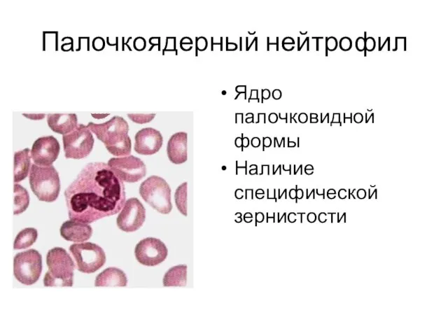 Палочкоядерный нейтрофил Ядро палочковидной формы Наличие специфической зернистости