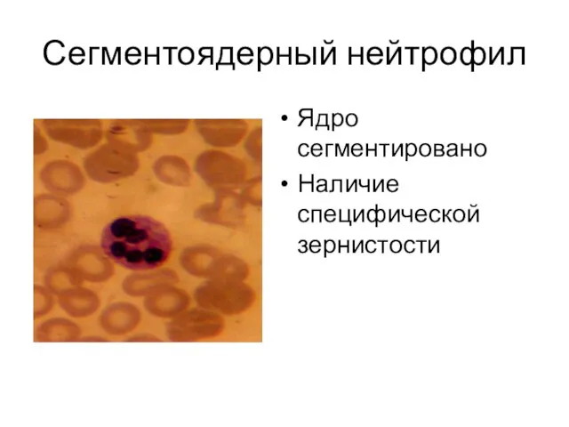 Сегментоядерный нейтрофил Ядро сегментировано Наличие специфической зернистости