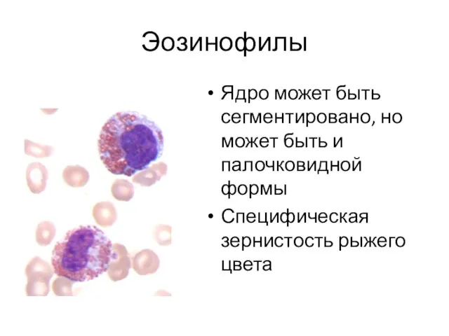 Ядро может быть сегментировано, но может быть и палочковидной формы Специфическая зернистость рыжего цвета Эозинофилы