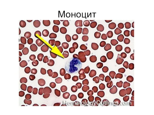 Моноцит