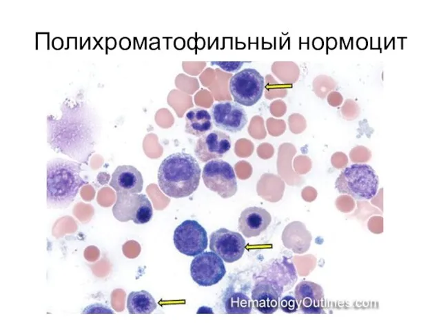 Полихроматофильный нормоцит