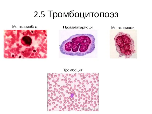 2.5 Тромбоцитопоэз Мегакариобласт Промегакариоцит Мегакариоцит Тромбоциты