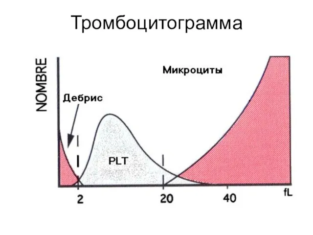 Тромбоцитограмма