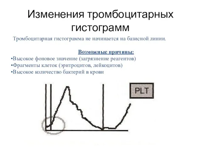 Тромбоцитарная гистограмма не начинается на базисной линии. Возможные причины: Высокое фоновое