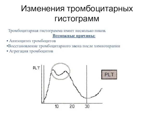 Тромбоцитарная гистограмма имеет несколько пиков. Возможные причины: Анизоцитоз тромбоцитов Восстановление тромбоцитарного