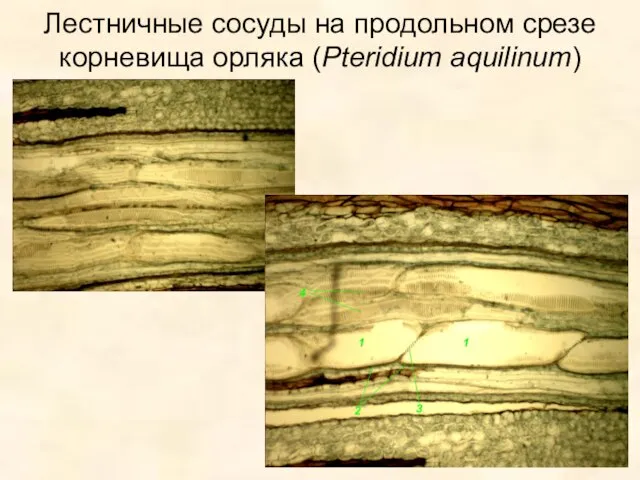 Лестничные сосуды на продольном срезе корневища орляка (Pteridium aquilinum)