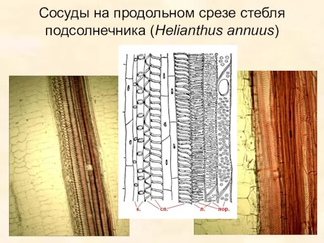 Сосуды на продольном срезе стебля подсолнечника (Helianthus annuus)