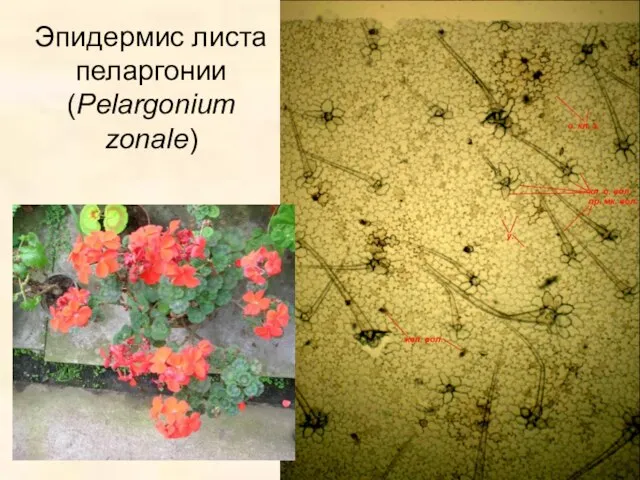 Эпидермис листа пеларгонии (Pelargonium zonale)