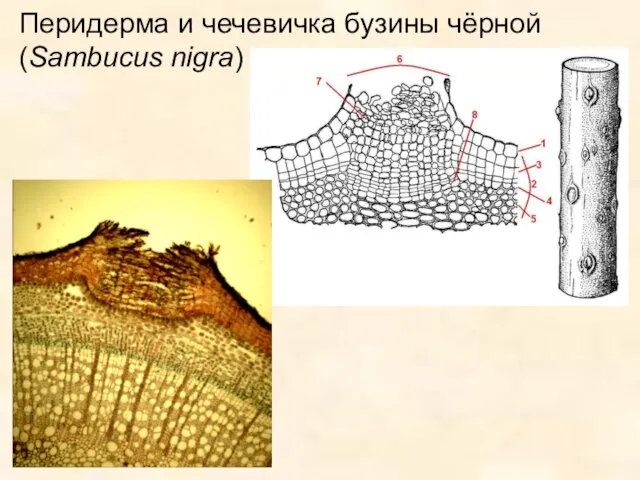 Перидерма и чечевичка бузины чёрной (Sambucus nigra)