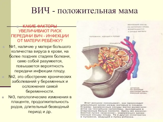 ВИЧ - положительная мама КАКИЕ ФАКТОРЫ УВЕЛИЧИВАЮТ РИСК ПЕРЕДАЧИ ВИЧ -