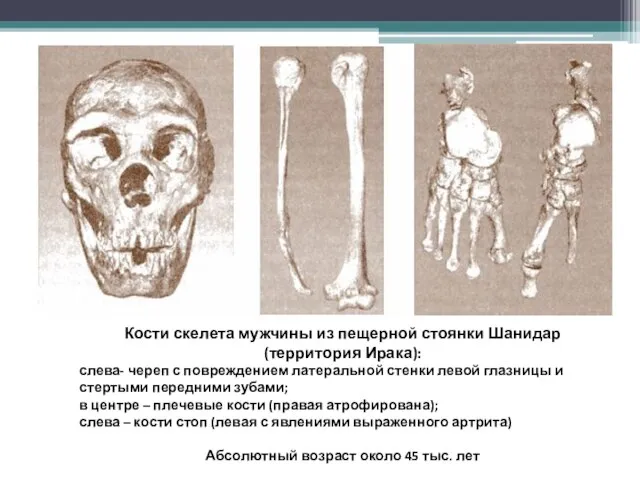 Кости скелета мужчины из пещерной стоянки Шанидар (территория Ирака): слева- череп