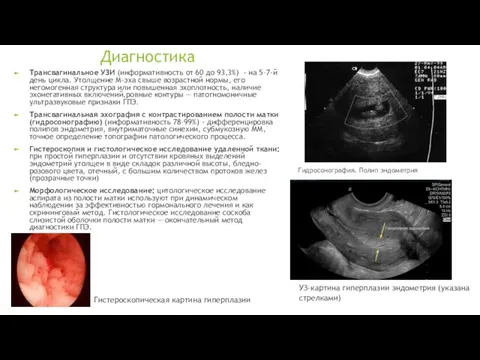 Диагностика Трансвагинальное УЗИ (информативность от 60 до 93,3%) - на 5–7-й