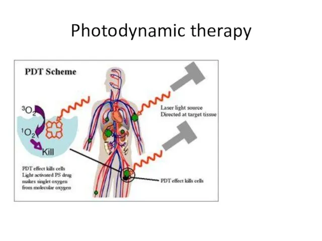 Photodynamic therapy