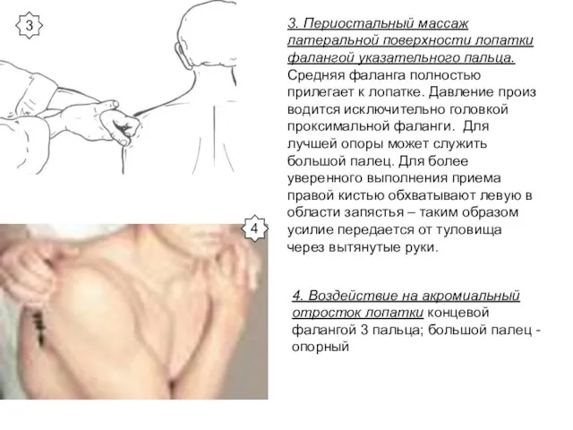 3. Периостальный массаж латеральной поверхности лопатки фалангой указательного пальца. Средняя фаланга