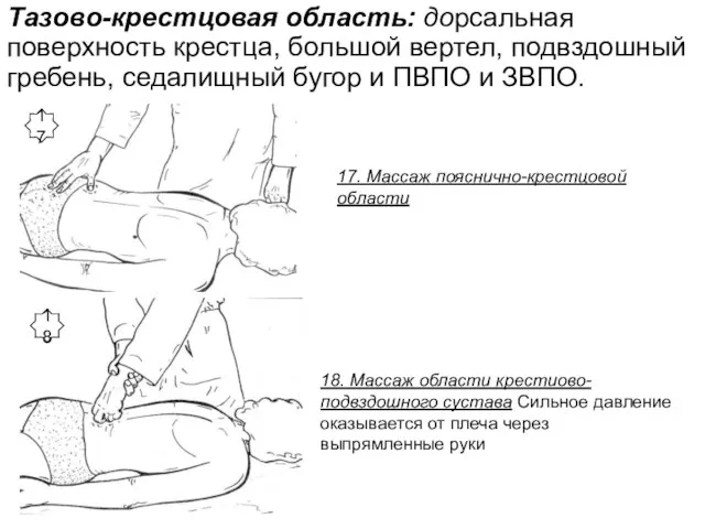 Тазово-крестцовая область: дорсальная поверхность крестца, большой вертел, подвздошный гребень, седалищный бугор