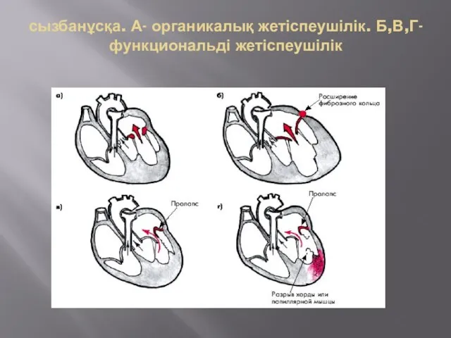 сызбанұсқа. А- органикалық жетіспеушілік. Б,В,Г- функциональді жетіспеушілік