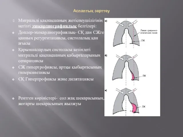 Аспаптық зерттеу Митральді қақпақшаның жетіспеушілігінің негізгі эхокардиографиялық белгілері: Доплер-эхокардиографиялық- СҚ дан