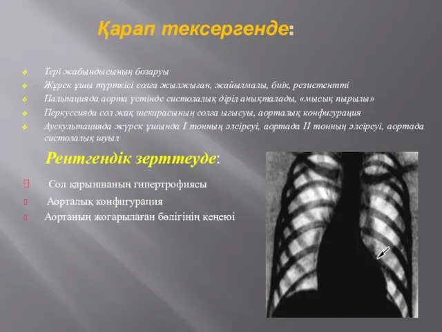 Қарап тексергенде: Тері жабындысының бозаруы Жұрек ұшы түрткісі солға жылжыған, жайылмалы,