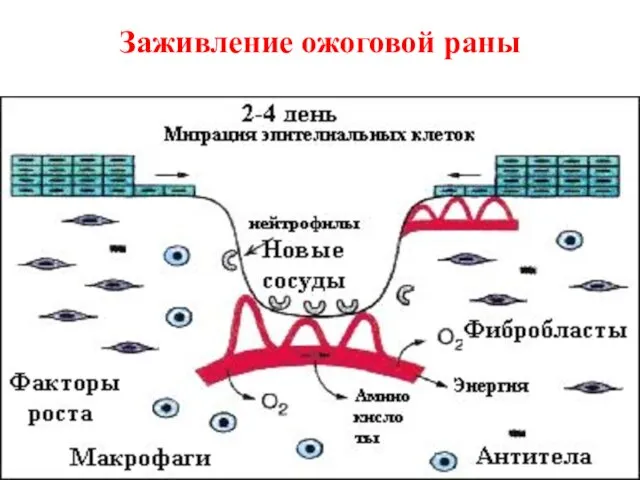 Заживление ожоговой раны