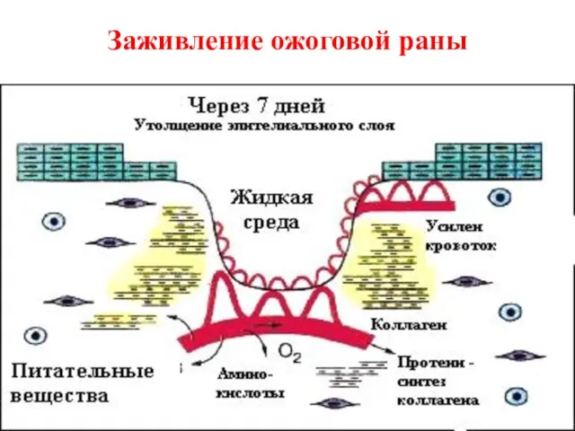 Заживление ожоговой раны