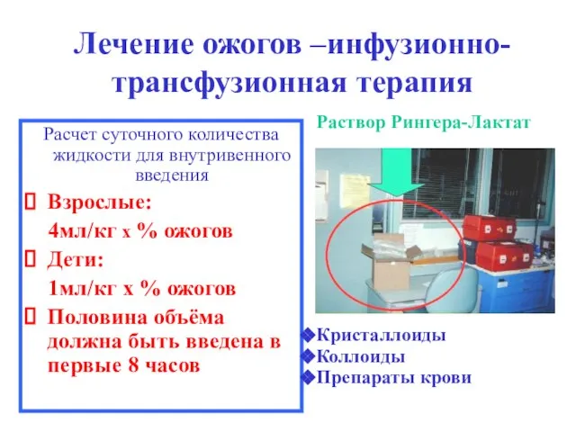 Лечение ожогов –инфузионно-трансфузионная терапия Расчет суточного количества жидкости для внутривенного введения