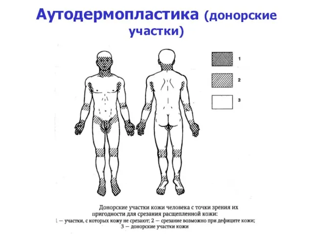 Аутодермопластика (донорские участки)