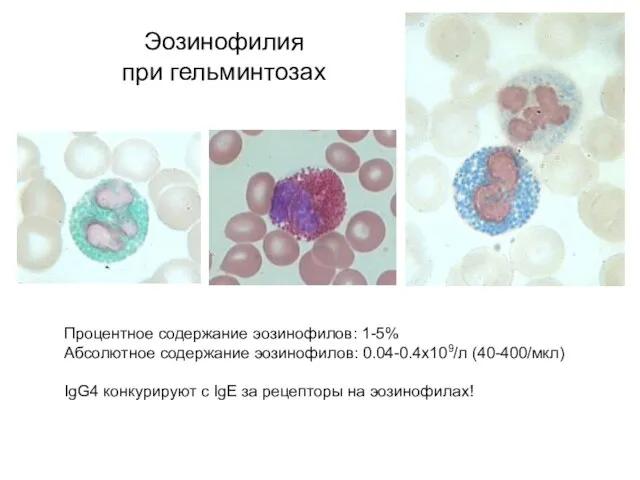 Процентное содержание эозинофилов: 1-5% Абсолютное содержание эозинофилов: 0.04-0.4x109/л (40-400/мкл) IgG4 конкурируют