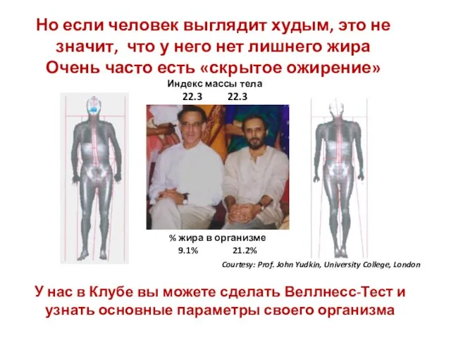 Courtesy: Prof. John Yudkin, University College, London Но если человек выглядит