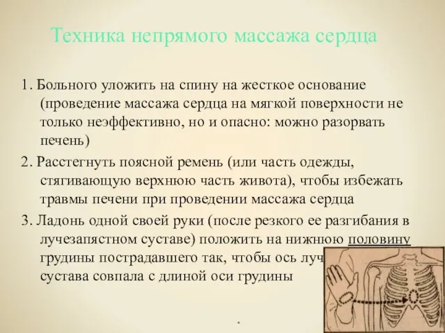 Техника непрямого массажа сердца 1. Больного уложить на спину на жесткое