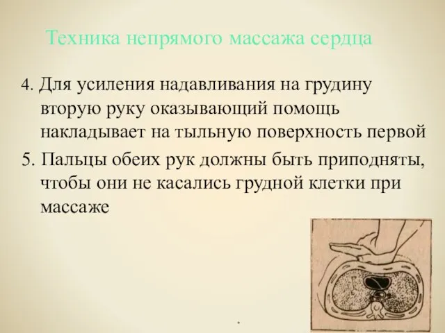 4. Для усиления надавливания на грудину вторую руку оказывающий помощь накладывает